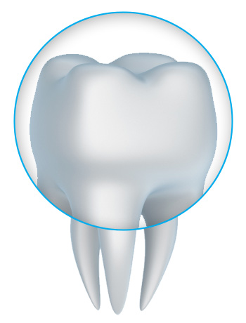 tooth crown and porcelain crowns with a South San Francisco dentist near Pacifica