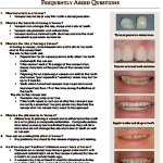 DentalVeneers