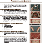 RemovablePartialDenture