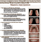 RemovablePartialDentureLocator