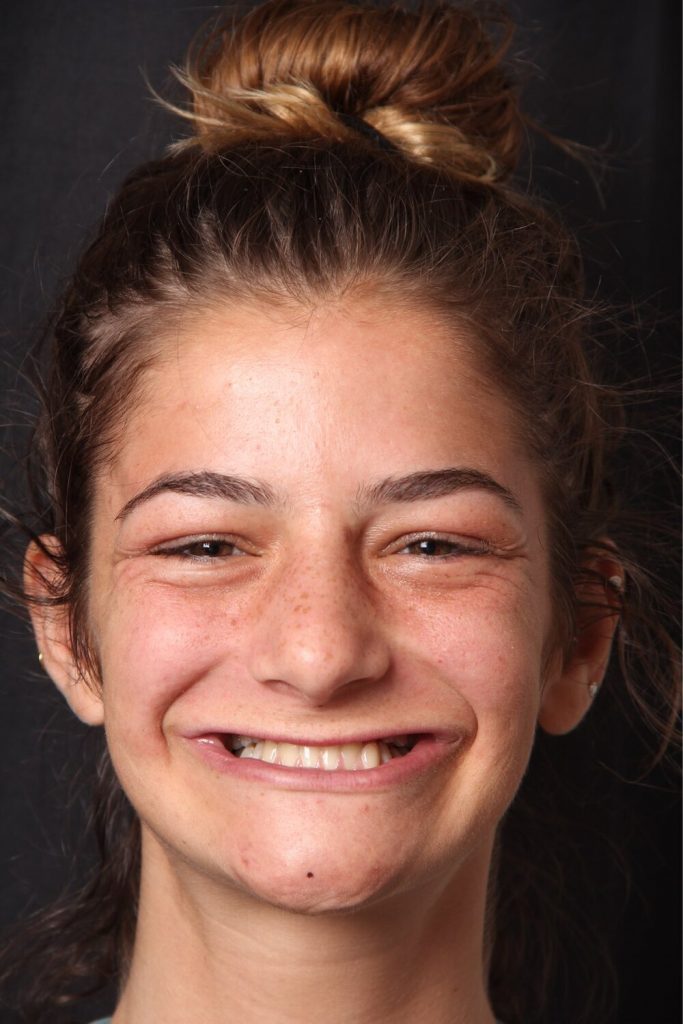 adrianna before