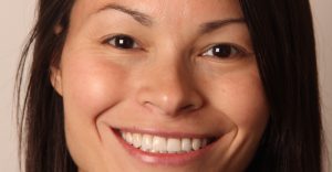 A Daly City porcelain veneers patient.